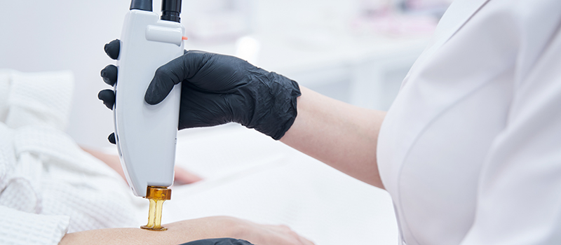 Long run of Dermatology: Rising Developments and Applied sciences – Calabria Process – Exploring Early Kid Construction